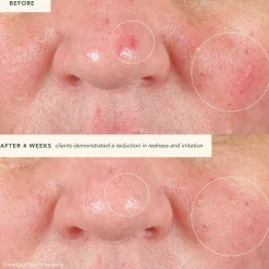Restoring Moonseed Treatment - Ayurvedischer Balm für Feuchtigkeit und Hautberuhigung